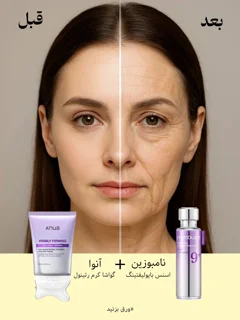 جوانساز آنوا و نامبوزین